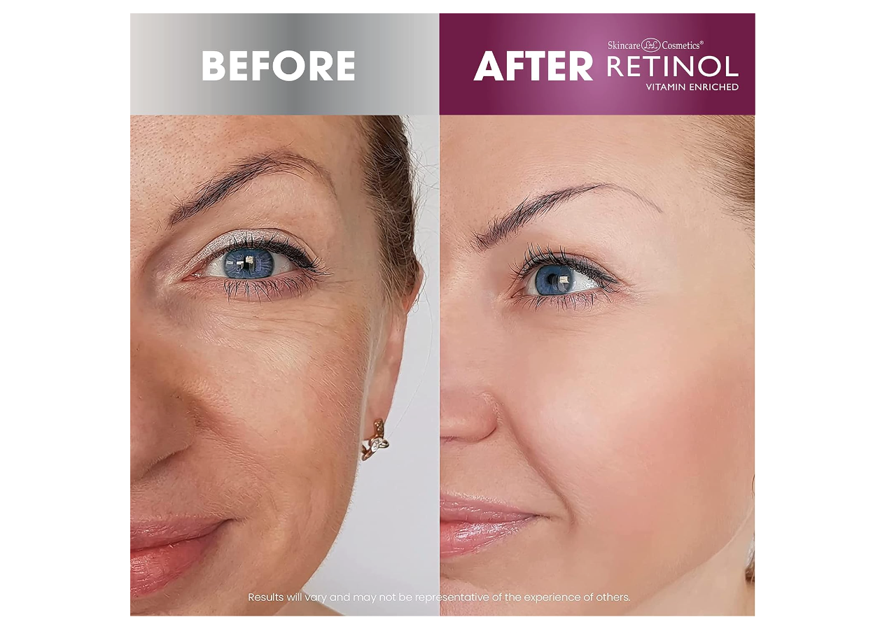 RETINOL Advanced Brightening Night Cream, 1.7 Oz. 48g