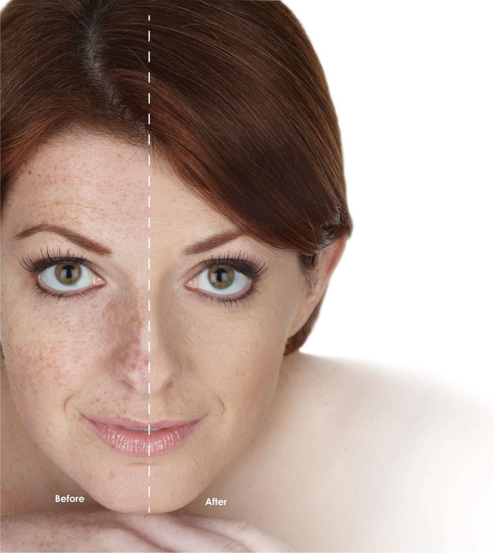 Hydroxatone Anti-Aging BB Cream
