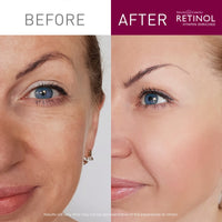 Retinol Anti-Aging Cream Cleanser [36320-000] Daily Facial Wash