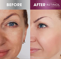 RETINOL Anti-Wrinkle Facial Serum