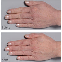 Perricone Cold Plasma Plus+ Hand Therapy